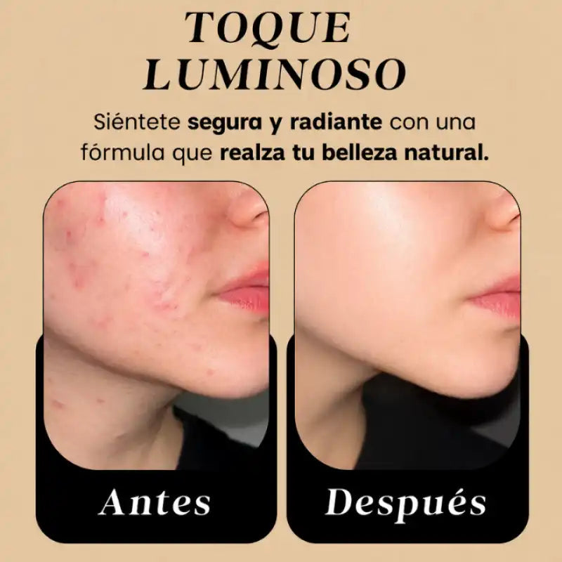💛¡PIEL DE PORCELANA EN MINUTOS CON ✨ (Cebo De Res)✨