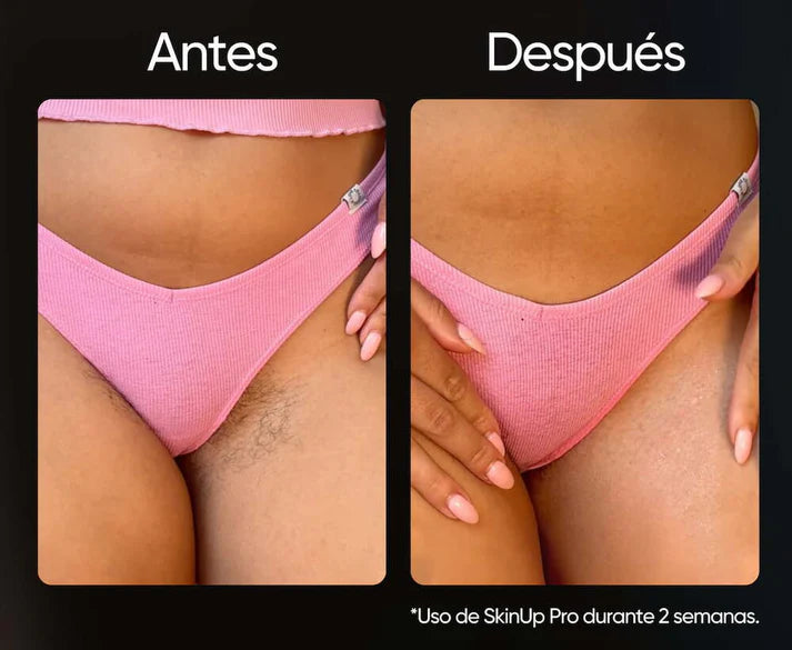 Depiladora Venus - Elimina el vello de raíz y cuida tu Piel- oferta + 3 REGALOS SOPRESA GRATIS
