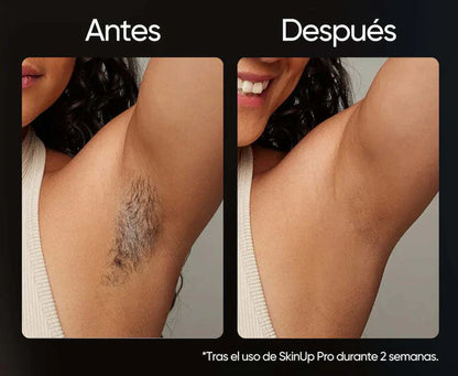 Depiladora Venus - Elimina el vello de raíz y cuida tu Piel- oferta + 3 REGALOS SOPRESA GRATIS