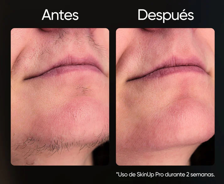 Depiladora Venus - Elimina el vello de raíz y cuida tu Piel- oferta + 3 REGALOS SOPRESA GRATIS