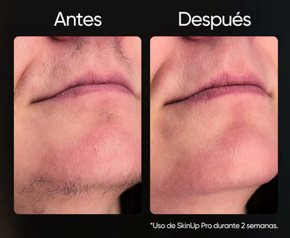 Depiladora Venus - Elimina el vello de raíz y cuida tu Piel- oferta + 3 REGALOS SOPRESA GRATIS